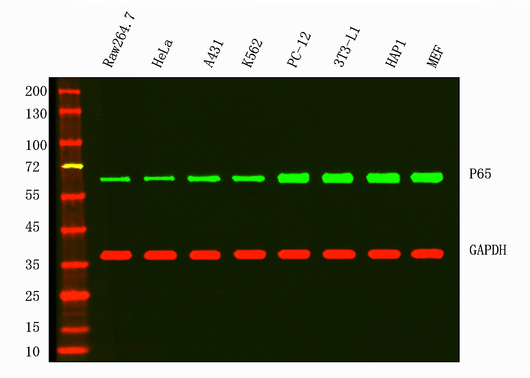 NF-&kappa;B p65 (R197I) Rabbit mAb