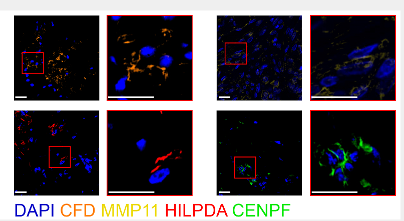 Mouse/Rabbit Tetra-Labeling Five-Color Fluorescence Detection Kit
